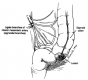 Low Anterior Resection, Triple-Staple Procedure (Kỹ Thuật Cắt Trực Tràng Trước Thấp-Nối máy)